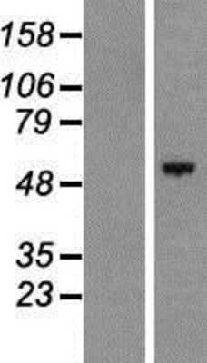 Western Blot: HEATR9 Overexpression Lysate [NBP2-05307]