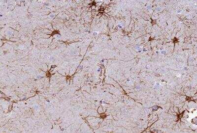 Immunohistochemistry-Paraffin: C17orf67 Antibody [NBP1-94155]