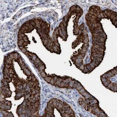 Immunohistochemistry-Paraffin: SPEM2 Antibody [NBP1-91065]