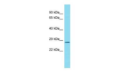 Western Blot: C17orf77 Antibody [NBP3-10743]