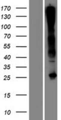 Western Blot: C17orf77 Overexpression Lysate [NBP2-05361]