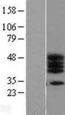 Western Blot: C17orf78 Overexpression Lysate [NBL1-08244]