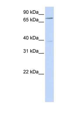 Western Blot: C17orf80 Antibody [NBP1-59973]