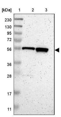 Western Blot: C17orf80 Antibody [NBP1-83637]