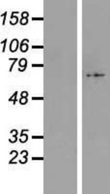 Western Blot: C17orf80 Overexpression Lysate [NBL1-08246]