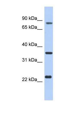 Western Blot: LINC02875 Antibody [NBP1-56810]