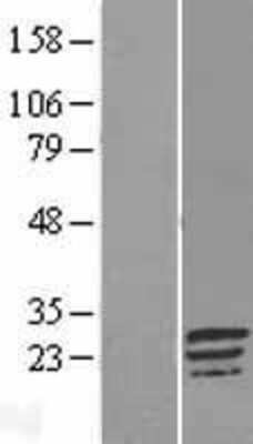 Western Blot: LINC02875 Overexpression Lysate [NBL1-08248]