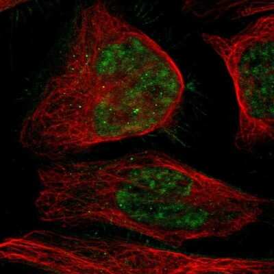 Immunocytochemistry/ Immunofluorescence: NCBP3 Antibody [NBP2-30657]