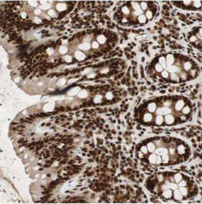 Immunohistochemistry-Paraffin: NCBP3 Antibody [NBP2-30657]