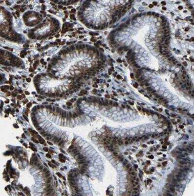 Immunohistochemistry: NCBP3 Antibody [NBP2-30658]