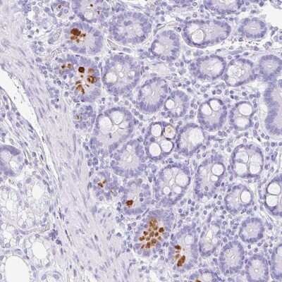 Immunohistochemistry-Paraffin: NDUFAF8 Antibody [NBP2-30582]
