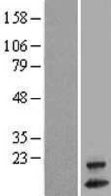 Western Blot: OXLD1 Overexpression Lysate [NBL1-08249]