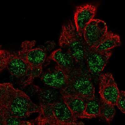 Immunocytochemistry/ Immunofluorescence: EPOP Antibody [NBP2-58098]