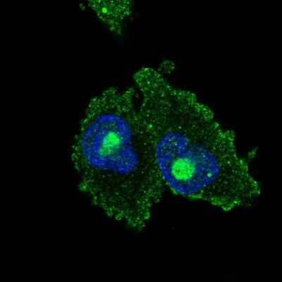 Immunocytochemistry/ Immunofluorescence: C18orf21 Antibody [NBP2-49449]