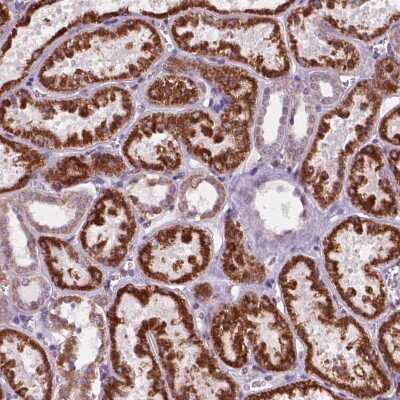 Immunohistochemistry: C18orf21 Antibody [NBP2-49514]