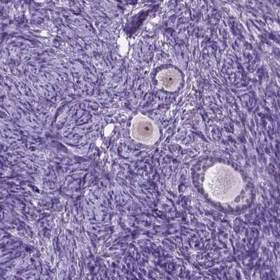 Immunohistochemistry-Paraffin: C18orf21 Antibody [NBP2-49449]