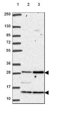 Western Blot: C18orf21 Antibody [NBP2-49449]