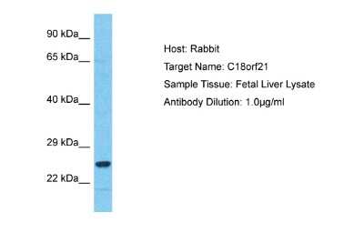 Western Blot: C18orf21 Antibody [NBP2-84542]