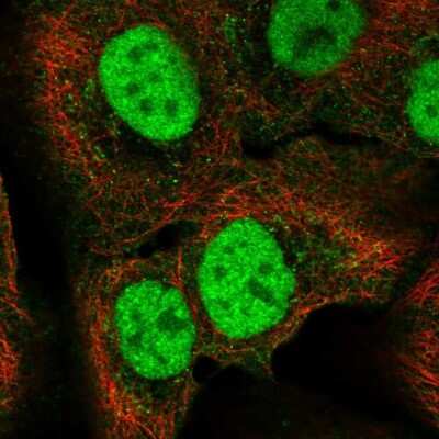 Immunocytochemistry/ Immunofluorescence: C18orf25 Antibody [NBP2-68825]