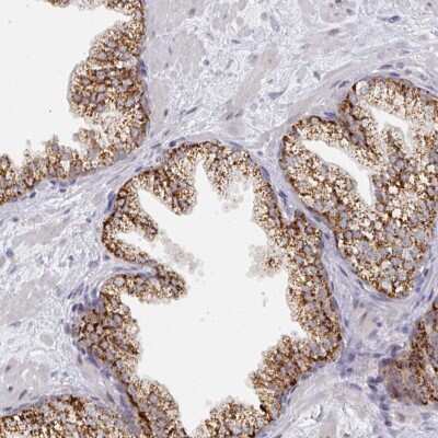 Immunohistochemistry: C18orf25 Antibody [NBP2-49000]