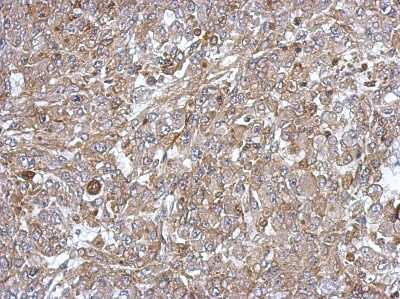 Immunohistochemistry-Paraffin: C18orf25 Antibody [NBP2-15636]