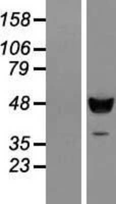 Western Blot: C18orf25 Overexpression Lysate [NBL1-08253]