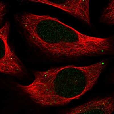 Immunocytochemistry/ Immunofluorescence: C18orf32 Antibody [NBP1-83585]