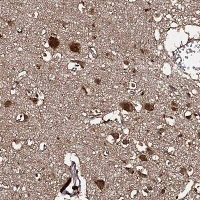 Immunohistochemistry-Paraffin: C18orf32 Antibody [NBP1-83585]