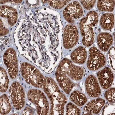 Immunohistochemistry-Paraffin: C18orf32 Antibody [NBP1-83585]