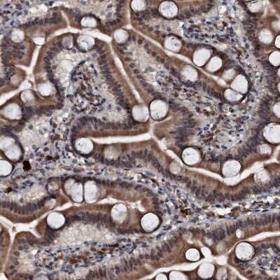 Immunohistochemistry-Paraffin: C18orf32 Antibody [NBP1-83585]