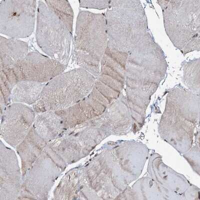 Immunohistochemistry-Paraffin: C18orf32 Antibody [NBP1-83585]