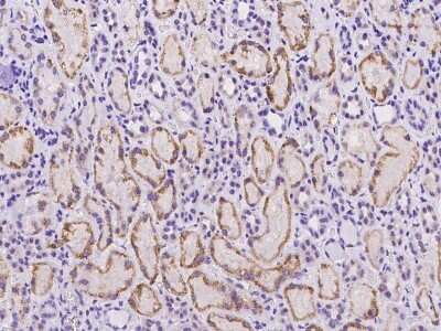 Immunohistochemistry-Paraffin: C18orf32 Antibody [NBP2-97386]