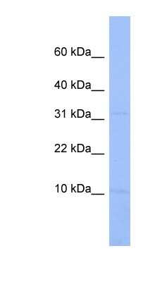 Western Blot: C18orf32 Antibody [NBP1-56827]