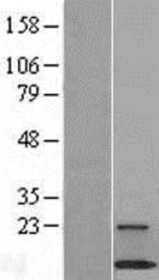 Western Blot: C18orf32 Overexpression Lysate [NBL1-08254]