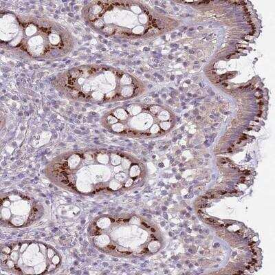 Immunohistochemistry-Paraffin: AKAIN1 Antibody [NBP2-14679]