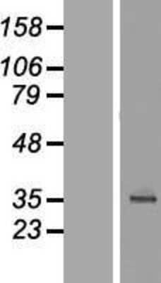 Western Blot: LAS2 Overexpression Lysate [NBL1-08256]