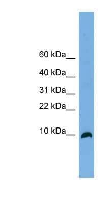 Western Blot: TYMS opposite strand Antibody [NBP1-57050]