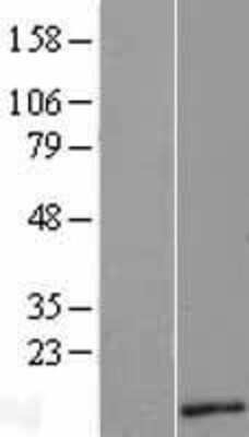 Western Blot: TYMS opposite strand Overexpression Lysate [NBL1-08258]