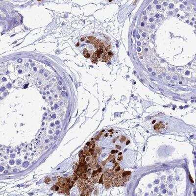 Immunohistochemistry: SMIM21 Antibody [NBP1-94149]