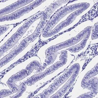 Immunohistochemistry-Paraffin: SMIM21 Antibody [NBP1-94149]