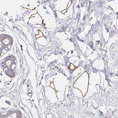 Immunohistochemistry-Paraffin: C19orf12 Antibody [NBP1-94063]