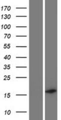 Western Blot: C19orf12 Overexpression Lysate [NBP2-09178]