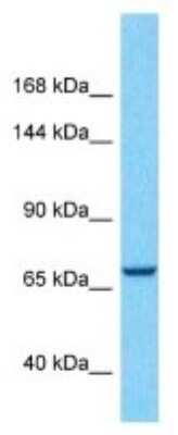 Western Blot: C19orf174 Antibody [NBP3-10773]