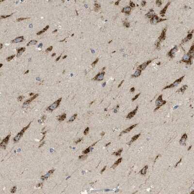 Immunohistochemistry-Paraffin: C19orf18 Antibody [NBP1-82690]