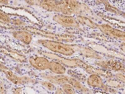 Immunohistochemistry-Paraffin: C19orf18 Antibody [NBP2-98176]