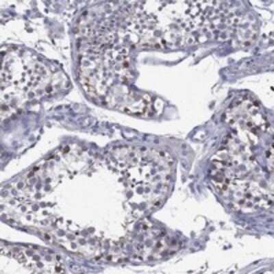 Immunohistochemistry-Paraffin: C19orf18 Antibody [NBP3-17350]