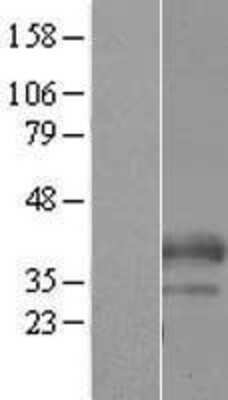 Western Blot: C19orf18 Overexpression Lysate [NBP2-05364]