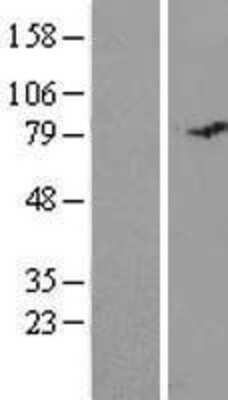 Western Blot: MISP1 Overexpression Lysate [NBL1-08263]