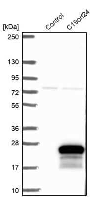 Western Blot: C19orf24 Antibody [NBP2-14800]