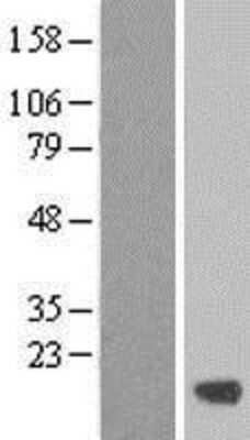 Western Blot: C19orf24 Overexpression Lysate [NBL1-08265]